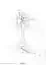 Fig. 02 - Device and method for injecting a biomaterial into body tissue