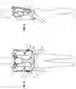 Fig. 04 - MODULAR EXOSKELETON STRUCTURE THAT PROVIDES FORCE ASSISTANCE TO THE USER
