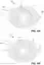 Fig. 07 - Methods for applying materials around protuberances