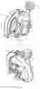Fig. 02 - Clamping device for handlebar