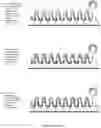 Fig. 09 - Method for identification and enumeration of nucleic acid sequence, expression, copy, or DNA methylation changes, using combined nuclease, ligase, polymerase, and sequencing reactions