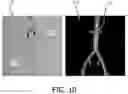 Fig. 09 - Systems and methods for determining the length of a non-shape-sensed interventional device with a shape-sensed guidewire and determining a state of the guidewire with respect to an interventional device