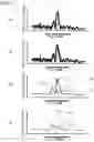 Fig. 05 - Doppler shift analysis device