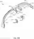 Fig. 22 - Eyeglasses with interchangeable lenses