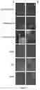 Fig. 12 - Method for quantitative measurement of a biomarker by in situ immunofluorescence and uses thereof