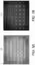 Fig. 06 - Automated visual recognition of a microcalcification
