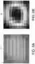Fig. 07 - Automated visual recognition of a microcalcification