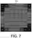 Fig. 08 - Automated visual recognition of a microcalcification