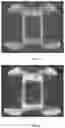 Fig. 06 - Methods and compositions for minimizing x-ray scattering artifacts