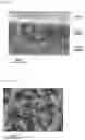 Fig. 06 - LITHIUM METAL ANODE, FABRICATION METHOD THEREROF, AND LITHIUM SECONDARY BATTERY COMPRISING SAME ANODE