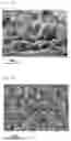 Fig. 07 - LITHIUM METAL ANODE, FABRICATION METHOD THEREROF, AND LITHIUM SECONDARY BATTERY COMPRISING SAME ANODE