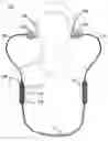 Fig. 01 - EAR PHONE SYSTEM