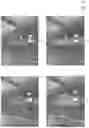 Fig. 07 - Method and device for distributing a particulate material