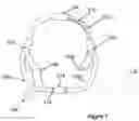 Fig. 08 - Water walking leash