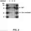 Fig. 03 - Parkinson's disease model and methods