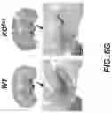 Fig. 13 - Parkinson's disease model and methods
