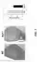 Fig. 15 - Parkinson's disease model and methods