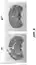 Fig. 17 - Parkinson's disease model and methods