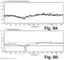 Fig. 11 - Absolute intrathoracic impedance based scheme to stratify patients for risk of a heart failure event
