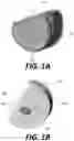Fig. 02 - Implant placement planning