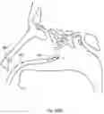 Fig. 366 - Robotic catheter system and methods