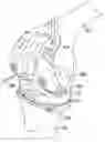 Fig. 01 - System and method for preparing a patient's femur in an orthopaedic joint replacement procedure