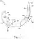 Fig. 06 - System and method for preparing a patient's femur in an orthopaedic joint replacement procedure