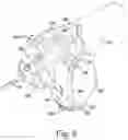 Fig. 07 - System and method for preparing a patient's femur in an orthopaedic joint replacement procedure
