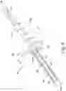 Fig. 09 - System and method for preparing a patient's femur in an orthopaedic joint replacement procedure