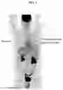 Fig. 02 - STEROID ADMINISTRATION AND IMMUNOTHERAPY