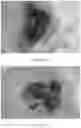 Fig. 38 - Use of nanoparticles for immunotherapy