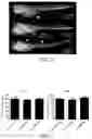 Fig. 02 - TUMOR CELL XENOGRAFT MODEL IN ZEBRAFISH, AND METHODS OF CONSTRUCTING AND USING THE SAME