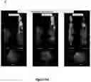 Fig. 06 - Compositions and methods for cancer imaging and radiotherapy
