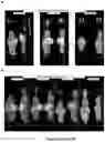 Fig. 08 - Compositions and methods for cancer imaging and radiotherapy
