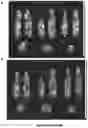 Fig. 09 - Compositions and methods for cancer imaging and radiotherapy