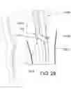 Fig. 22 - UNITARY BODY SYSTEMS AND DEVICES AND METHODS TO USE THE SAME FOR RETROPERFUSION