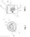 Fig. 02 - Counting apparatus for use in interventional procedures