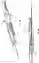 Fig. 06 - Catheter placement device and method