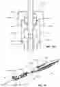 Fig. 85 - Catheter insertion device including top-mounted advancement components