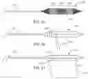 Fig. 09 - HIGH-PRESSURE BALLOON CATHETERS AND METHODS
