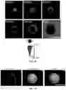 Fig. 09 - Core-shell microneedle devices and uses thereof