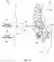 Fig. 02 - Implantable medical lead with threaded fixation