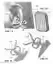 Fig. 07 - Transcutaneous electrostimulator and methods for electric stimulation