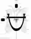 Fig. 09 - Head neck immobilization wrap