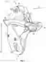 Fig. 02 - Fall-protection apparatus with braking system