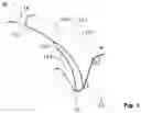 Fig. 02 - Method for grinding finish machining of gearwheels