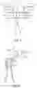 Fig. 09 - Beverage extractor for sparkling beverages