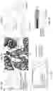 Fig. 03 - MCT4 inhibitors and uses thereof