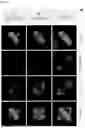 Fig. 04 - SELECTIVE AURORA A KINASE INHIBITORS