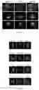 Fig. 07 - Mutants of recombinant immunoregulatory protein of and applications thereof